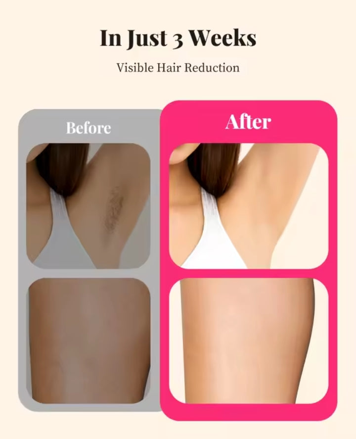 LumaGlow™ UltraSmooth IPL Hair Remover